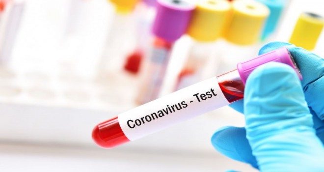 Azərbaycanda koronavirus testlərinin sayı açıqlandı