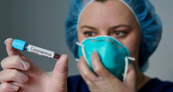 Daha 101 nəfərdə koronavirus aşkarlandı - 1 nəfər vəfat etdi, 53-ü sağaldı